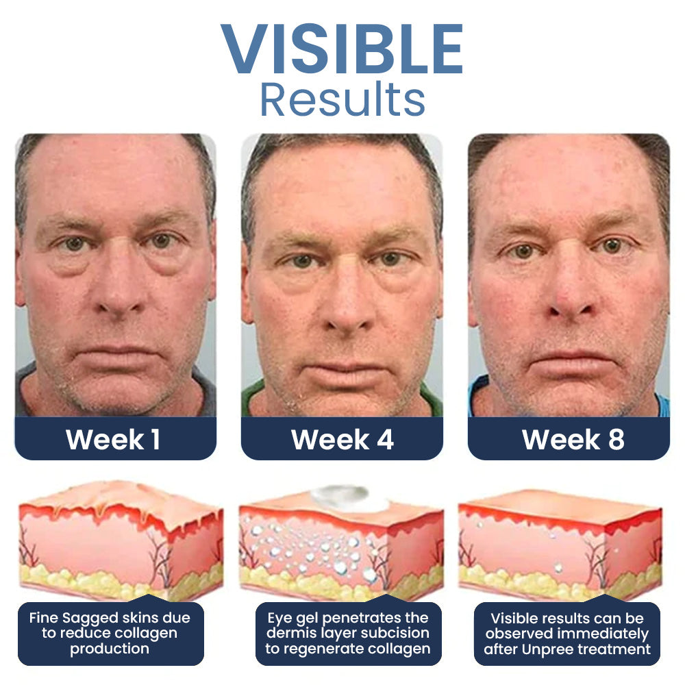 🔥 Seurico™ PEPTIDE Depuffing Eye Serum 🔥 LAST DAY SALE 80% OFF 🔥