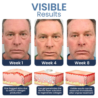 🔥 Seurico™ PEPTIDE Depuffing Eye Serum 🔥 LAST DAY SALE 80% OFF 🔥